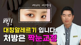 [성형정보] 짝눈교정시 한쪽만 수술이 가능할까?? 짝눈수술에 대해 알아보자.