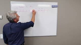 Pacing Failures made easy