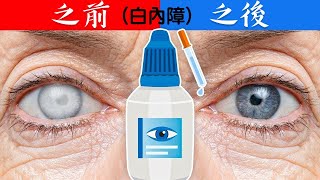 白內障青光眼,最棒2種自然療法!!,柏格醫生 Dr Berg