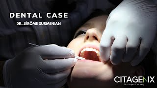 Bone Grafting Dental Case Using THE Graft Xenograft | Citagenix