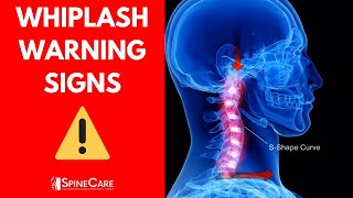 5 WARNING Signs of a Whiplash Injury | Discussed by St. Joseph MI Chiropractor