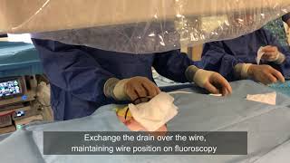 ERCP Top Tips: Percutaneous SpyGlass Cholangioscopy Setup