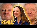 Unbelievable Face Transformation Gives Woman A Huge Confidence Boost! | The Bad Skin Clinic