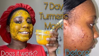 7 Day Turmeric Face Mask For Dark Spots | Honest Review