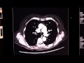 64 slice ct versus 4 slice ct what s the difference