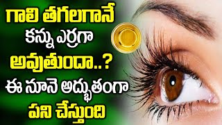 గాలి తగలగానే కన్ను ఎర్రగా అవుతుందా..? | This Oil Clears All Eye Problems | Dr Gummadavelli