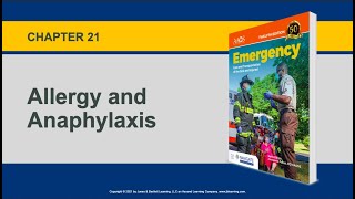 Chapter 21, Allergy and Anaphylaxis
