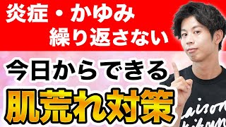 秋にアトピーを抑えるためのポイント【主にスキンケア・保湿など】