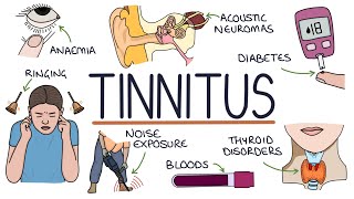 Understanding the Causes of Tinnitus