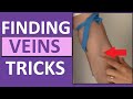 How to Find a Vein When Starting Ivs or Drawing Blood Tips in the Arm