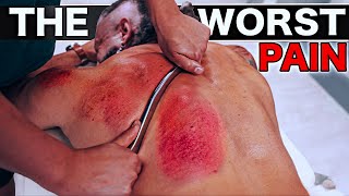 The WORST PAIN! Releasing TRAPPED BLOOD | Gua Sha Treatment for Back Pain!