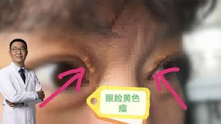 眼睑黄色瘤，是血脂高造成的，还是皮肤病？心脏医生却这样说！