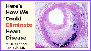 Webinar: Here's How We Could Eliminate Heart Disease (ft. Dr. Michael Farkouh) | Dr. Curnew MD
