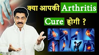 How to treat Arthritis properly | Rheumatoid Arthritis | Osteoarthritis | Longlivelives Hindi