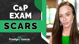 What to Expect in a Scars C&P Exam | VA Disability