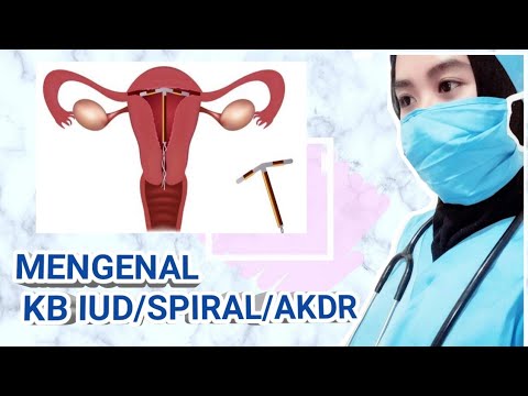 MENGENAL KB IUD By: Wilan Tika - YouTube