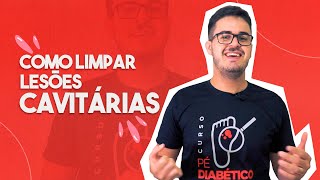 Como limpar lesões cavitárias | Unicicatriza