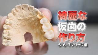 【仮歯】５・６・７ブリッジのテックを綺麗に作る方法