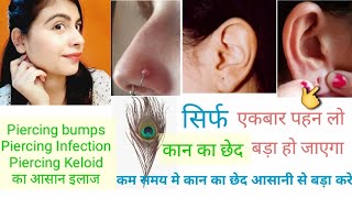कान का छेद बड़ा करने का आसान उपाय ll Ear hole size increase naturally at home ll Piercing Bumps ll