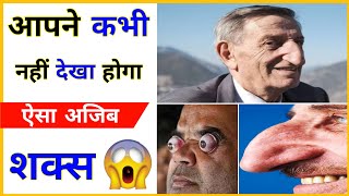 🤯दुनिया का सबसे अजीब आदमी ||😱 The Strangest Man in The World ||🌍 #shorts #youtube_shorts