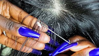 {ASMR} Super Intense 🤯 Scalp Scratching \u0026 PICKING | ALLZOOMED | layered sounds