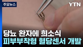 당뇨 환자에 희소식...피부 부착형 혈당 센서 개발 / YTN