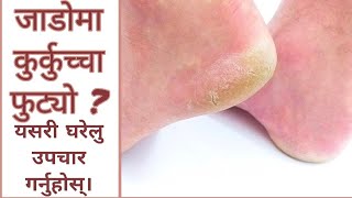 जाडो मौसममा खुट्टा कुर्कुचा को स्याहार र हेरबिचार यसरी गर्नुहोस् । Care of legs during winter season