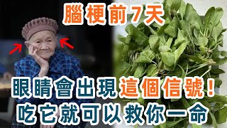 55歲以上的注意了！腦梗來臨前7天，眼睛會出現這信號！提前多吃這種菜，可以讓你遠離腦梗中風，救你一命【養生1+1】