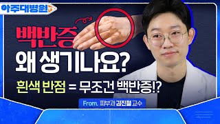 어느 날 몸에 나타난 흰색 반점💀 ‘백반증’ 발생 원인부터 치료법까지! (feat. 완치 가능?!) 피부과 김진철 교수 [아주대병원TV]