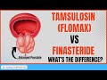 Tamsulosin (Flomax) Vs Finasteride for Benign Prostatic Hyperplasia | Side Effects You MUST Know