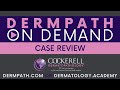 Case Review | Episode 30