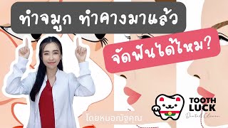 ทำจมูกทำคางมาแล้ว จัดฟันได้ไหม? - หมอณัฐคุณ