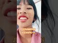 dista jerawatan kenapa 🤗 shortviral lucu viralvideo