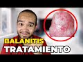 CÓMO CURAR LA BALANITIS