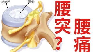 腰突的演化過程：腰椎間盤突出到底是怎麼一回事？｜白白的實驗室