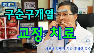 구순구개열 교정 치료 자세하게 알려드려요~!