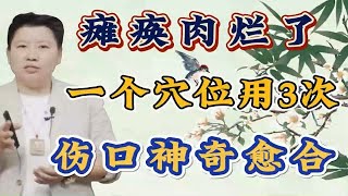 董氏奇穴刘红云：下半身瘫痪烂肉别慌，这个穴位用三次，神奇愈合