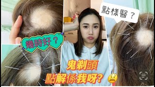 媽呀😱！我中咗鬼剃頭呀！😩｜究竟點算？｜有冇得醫？🧐