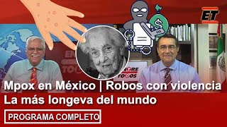 20 agosto | Mpox en México | Robos con violencia | La más longeva del mundo