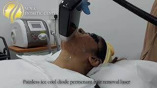 Permeant hair removal laser Sri Lanka by Nova esthetic center