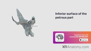 Temporal Bone   Inferior surface of petrous part