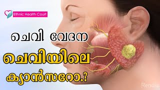 ചെവി വേദന; ചെവിയിലുണ്ടാകുന്ന കാന്‍സറിന്റെ പ്രധാനലക്ഷണം| Ethnic Health Court