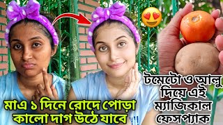 মাত্র এক দিনে রোদে পোড়া কালো দাগ দূর করবে 😱💯এই টমেটো ও আলু দিয়ে ফেসপ্যাক😍//sun tan remove at home