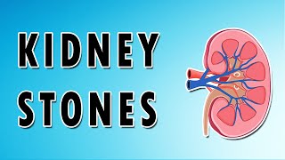 What Causes Kidney Stones