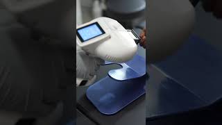 Excimer Laser Procedure