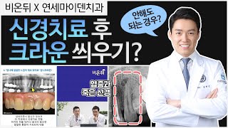 [의학채널비온뒤×연세마이덴치과] 앞니에 얼얼한 느낌❗ 신경치료 후 크라운이 필요없는 경우❓