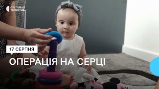 «Перша в історії української медицини»: операція на серці 8-місячної Ніколь