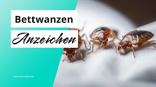 Seltsame Bisse am Körper? So erkennst du, ob es sich um Bettwanzen handelt