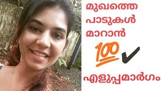 For spotless skin | മുഖത്തെ പാടുകൾ മാറാൻ 💯✔ ഫലപ്രദം.