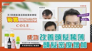 【真實用家分享】防脫髮激活頭皮更新療程 #激活毛囊 #延緩毛囊老化 #改善脫髮